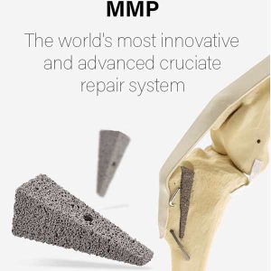 Tibial Tuberosity Advancement (TTA)
