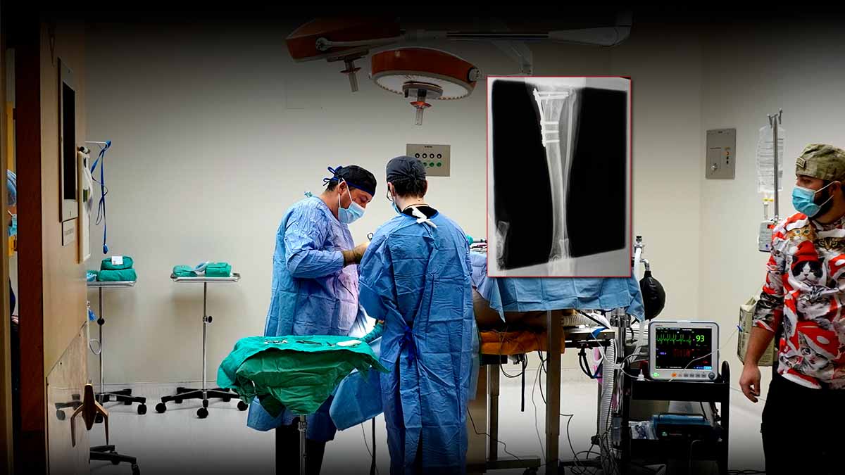 TLC Surgical Team Performing TTA